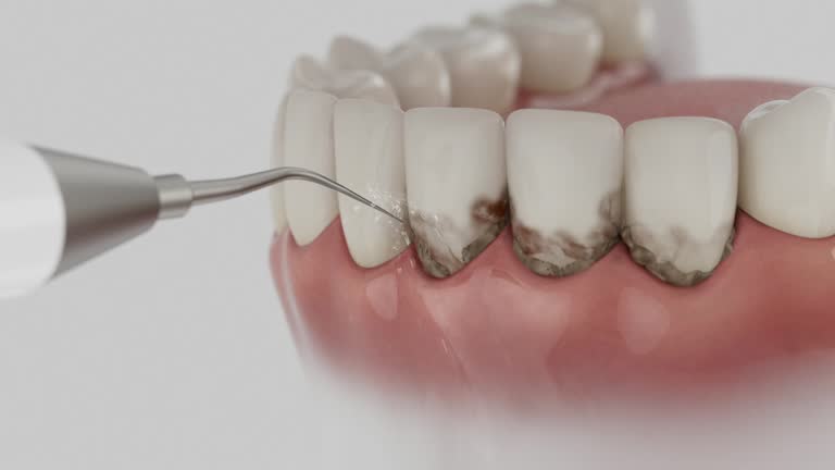 Reliable Emergency Dentist contractor in Brusly, LA by Smile Center Dentistry